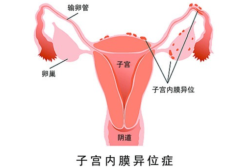 杭州捐卵机构：杭州有做供卵试管医院吗？