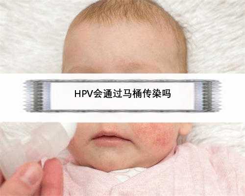 HPV会通过马桶传染吗
