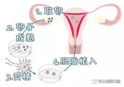 浙江代生孩子妈妈,杭州供卵试管婴儿代生医院排名