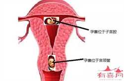 杭州代孕能得多少钱,供卵试管婴儿合法吗，马斯克代孕女儿曝光