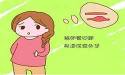 <b>杭州爱心招聘捐卵,2023南京民间捐卵组织排名哪家强？附费用明细？</b>