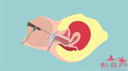 杭州寻代孕女,供卵试管婴儿合法吗，马斯克代孕女儿曝光