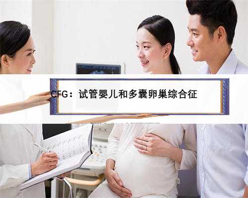 CFG：试管婴儿和多囊卵巢综合征
